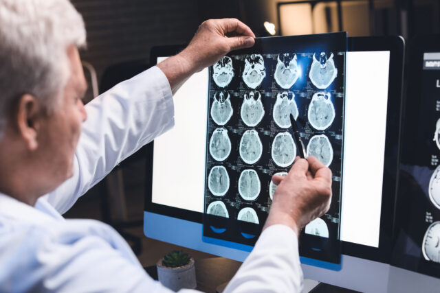 doctor MRI scan of brain